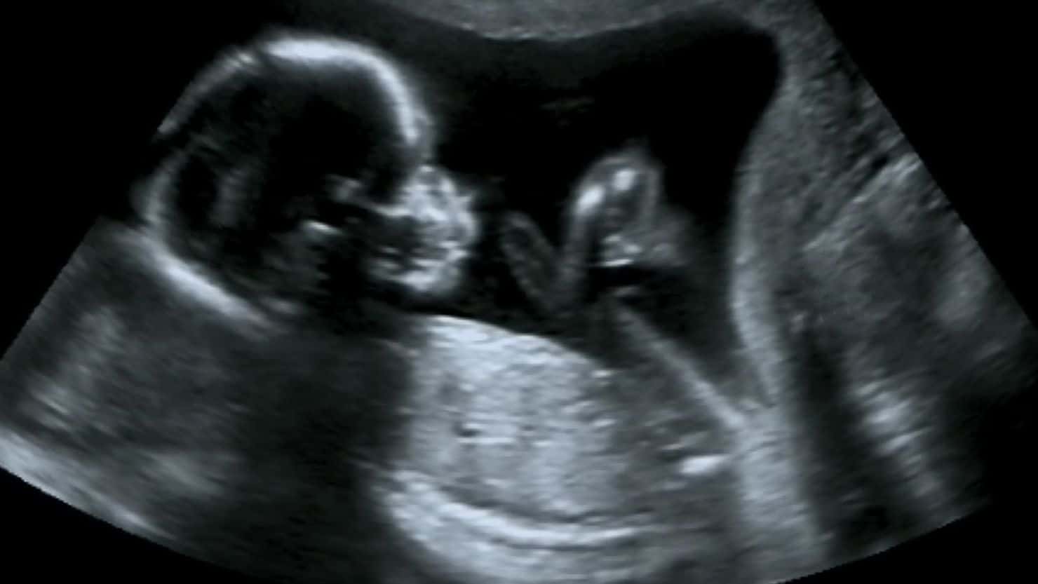 Ultrasound-Preborn-Baby